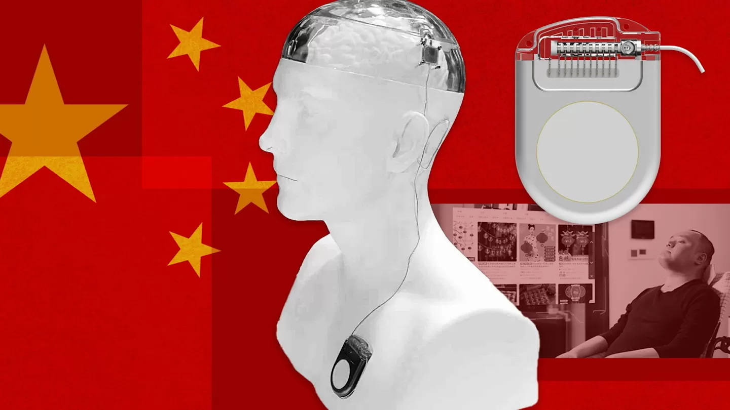 China Überholt Neuralink Mit Kommerziellem Gehirnchip